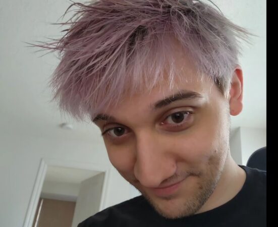 Из-за негативных эмоций Arteezy перекрасил волосы