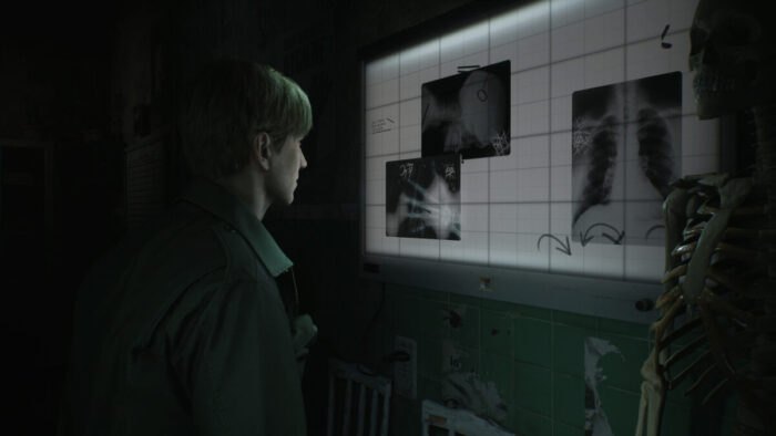 Согласно утечке, тизеры Silent Hill 2 Remake, Townfall и Ascension появятся “скоро”